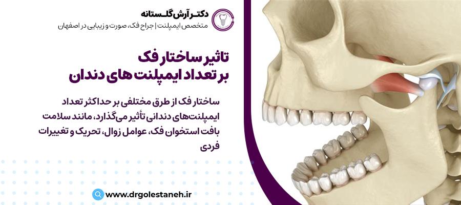 ساختار فک چگونه بر حداکثر تعداد ایمپلنت‌های دندانی تأثیر می‌گذارد؟ | دکتر آرش گلستانه در اصفهان