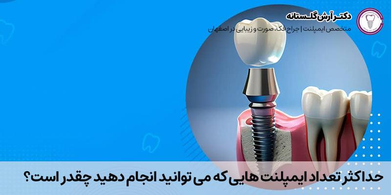 حداکثر تعداد ایمپلنت هایی که می توانید انجام دهید چقدر است؟ | دکتر آرش گلستانه در اصفهان