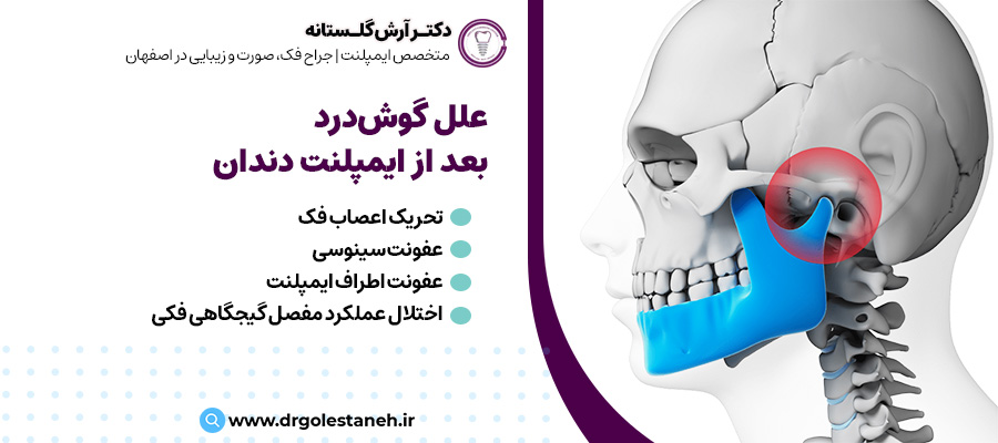 علل گوش درد بعد از ایمپلنت دندان | مطب دکتر آرش گلستانه در اصفهان