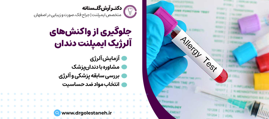 جلوگیری از واکنش‌های آلرژیک قبل از ایمپلنت دندان | دکتر آرش گلستانه در اصفهان