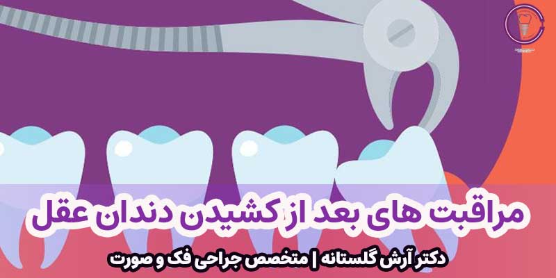 مراقبت های بعد از کشیدن دندان عقل