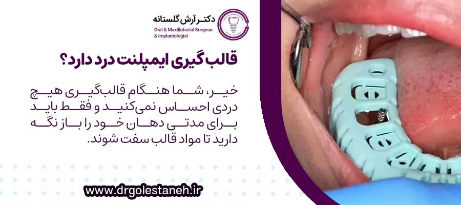 قالب گیری ایمپلنت درد دارد؟
