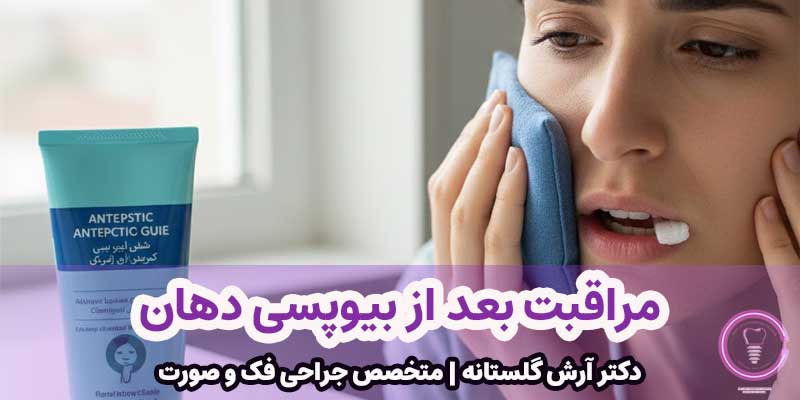 مراقبت بعد از بیوپسی دهان
