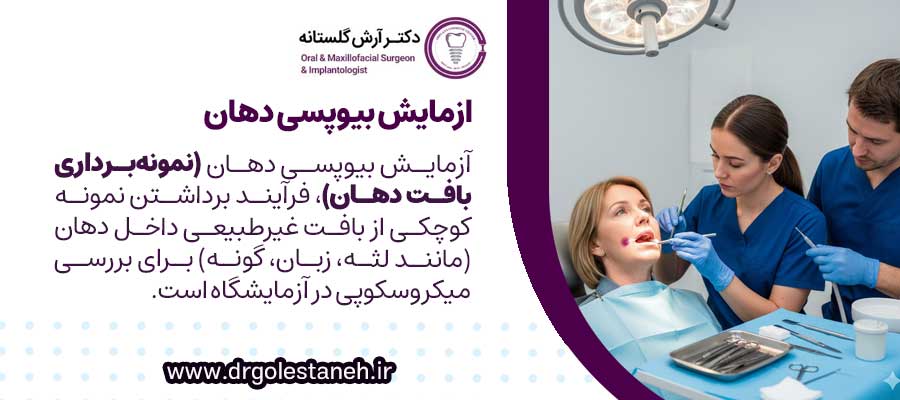 ازمایش بیوپسی دهان