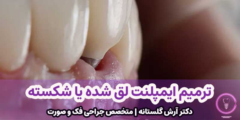 ترمیم ایمپلنت لق شده یا شکسته