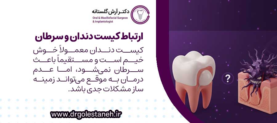 ارتباط کیست دندان و سرطان: شایعه یا واقعیت؟