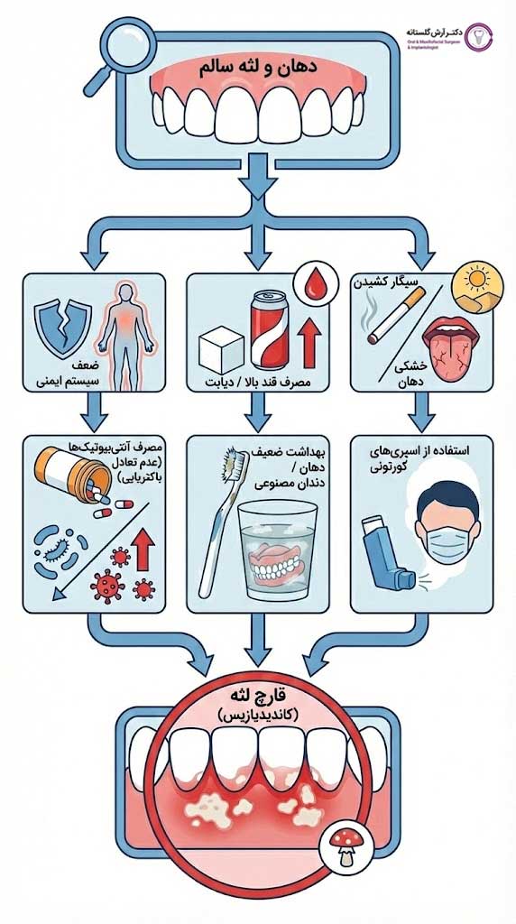 علت قارچ لثه چیست؟