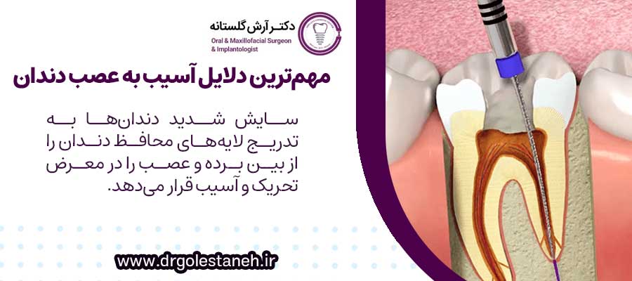 مهمترین دلایل آسیب به عصب دندان چه شکلی است؟