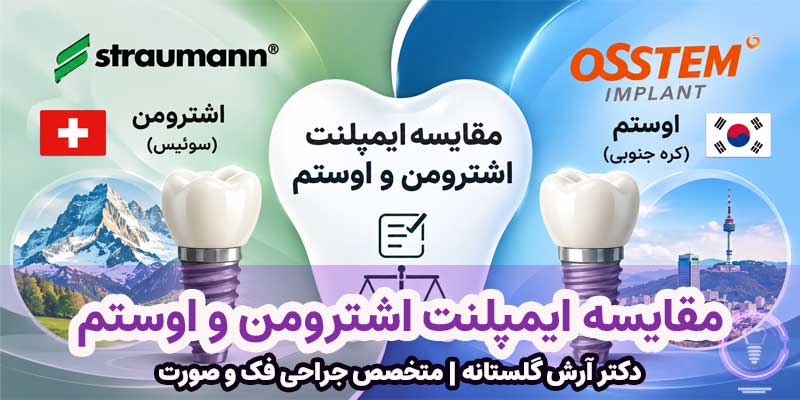 مقایسه ایمپلنت Straumann و Osstem
